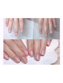 爪の悩みを解消できる（ケア含む）