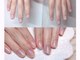 アモールネイル(amor nail)の写真/深爪でお悩みの方には美爪育成コース◎コンプレックスも自信に変わる体験を。美爪育成が得意なサロンです♪