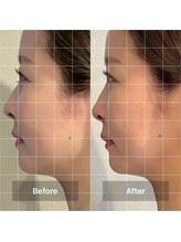 ミームスパ 梅田中崎町(Meem Spa)/【龍の手ヘッドスパ】