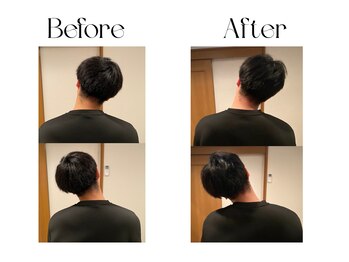 ヴィボーン(Vibone)/1度の施術で効果を実感!