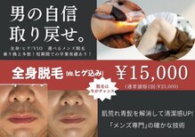 アールティー(RT)