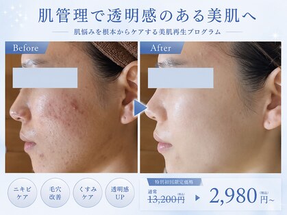 エステティック レイビス 池袋店(RAYVIS)の写真