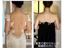 蒼(so)の雰囲気(11~2月挙式&特別な日為の方多数来店。至高の鎖骨・肩甲骨矯正。)