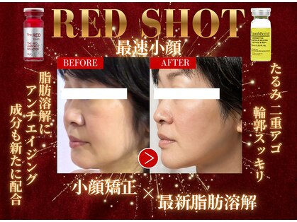 モテ美白の写真