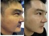 【つるつる男性美肌】男性人気★★韓国美容ミラクルダイヤモンドピール