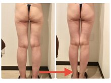 リズ(Liz)/美脚になりたい