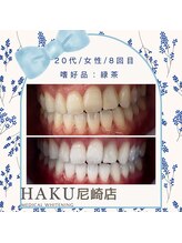 ハク 尼崎店(HAKU)/◆ホワイトニング施術写真◆