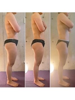 サプナジー(Suppnrgy)/カスタムトリートメント