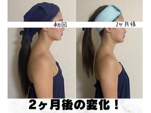 お顔の研究所の雰囲気（小顔技術で姿勢矯正も【小顔/小顔矯正/たるみケア/マッサージ】）