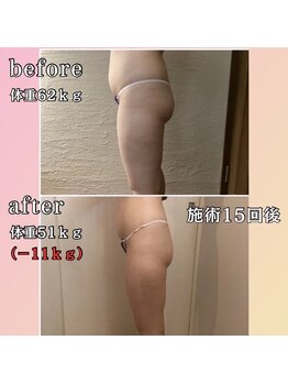 プリマジュール/【圧倒的な効果】サーモシェイプ