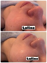 ラ リノ 星ヶ丘(La Lino)/艶肌