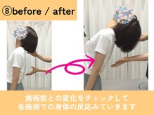 整体院 來花 福岡薬院店(KOHANA)/８，before / after