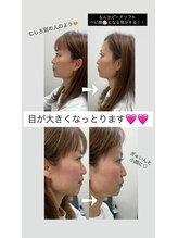 クレール 小山店(CLAIR)/小顔施術