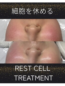 リヴィア(LIVIA)/細胞を休めて美肌の土台作りを!