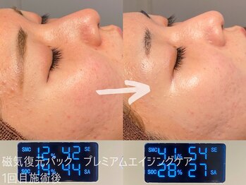 ルーナジェーナ(Luna llena)/池袋　エステ　ルーナジェーナ