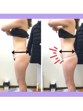 ピアリーノ(Pialino)/たった1回！ビフォーアフター