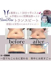 アクアリジェ/お着替え無のお手軽痩身