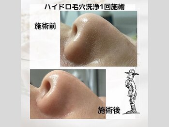 おにぎり(ONIGIRI)/★お客様結果★