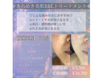 アミオ(amio)