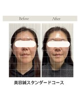 サロン ド ハリッシュ(Salon de HARISH)/モニター様