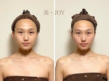 美 ジョイ(美 JOY)/小顔コルギ　施術例