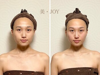 美 ジョイ(美 JOY)/小顔コルギ　施術例