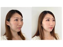 スタイルキューピット(style cupit)/メイクビフォアフター＊30代