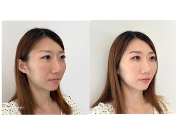 スタイルキューピット(style cupit)/メイクビフォアフター＊30代