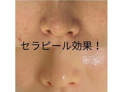 ポリー(Polly)の写真