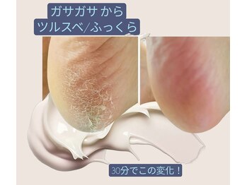 ラヴィ(La vie)/冬の乾燥の前に今！