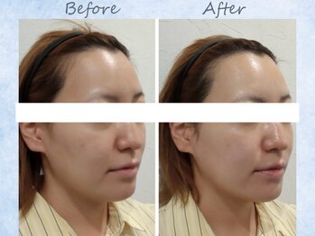 スキンスタジオ レア(Lea)/