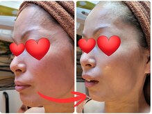 ムー ブランチ(Mou Branch)の雰囲気（Ｎｅｗマシーン，プラズマフェイシャルあらゆる肌悩みに対応！）