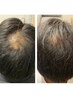 【メンズ限定★育毛促進エッセンスで臭いも撃退】 極上ドライヘッドスパ90分