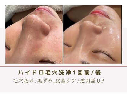 ルナビューティー 赤坂(LUNA beauty)の写真