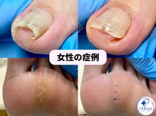 プラスワンフット 本厚木(+1 Foot)