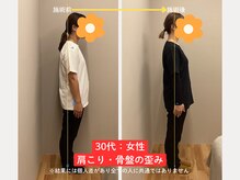 ソルム(solmu)/