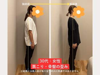 ソルム(solmu)/