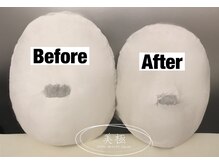 美極 トータルビューティー(美極 TOTAL BEAUTY)/恵比寿/小顔コルギ/エステ/