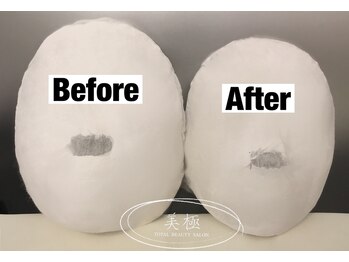 美極 トータルビューティー(美極 TOTAL BEAUTY)/恵比寿/小顔コルギ/エステ/