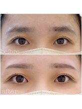 ブリッランテ(Brillante)/美眉♪ビフォア&アフター！