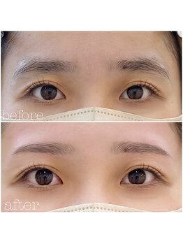 ブリッランテ(Brillante)/美眉♪ビフォア&アフター！