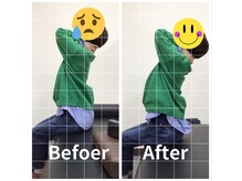 ナオル整体 勝田台院(NAORU整体)/施術事例【30代女性】猫背