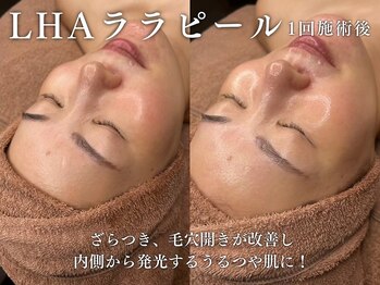 エムラボ 麻布十番店(M LABO)/LHAララピール