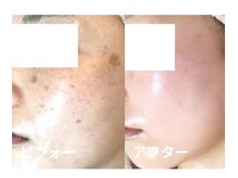 ドクターエイジレス(DR.AGELESS)/すっぴんをエイジレスに美肌育！