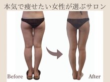 プレジィール 小顔 痩身専門店(PlaisiR)