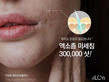 ラ ドゥーサ(La Dusa)/肌質改善に効果◎エクソソーム