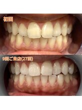 アデル 久留米(ADEL)/ビフォーアフター