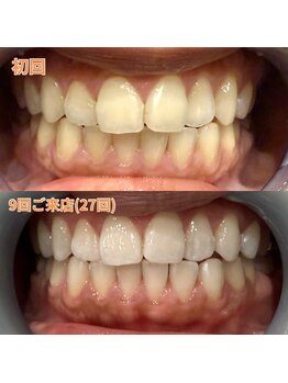 アデル 久留米(ADEL)/ビフォーアフター