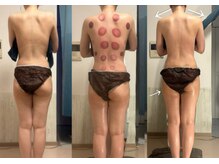 オーシャンブルーム 目黒(OceanBloom)/ハイパーナイフ代謝アップ