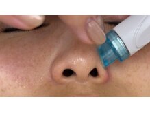 エヌフェイシャル(N.facial)/小鼻ピーリング